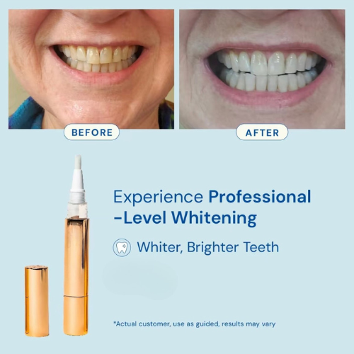 BrightSmile Whitening Pen