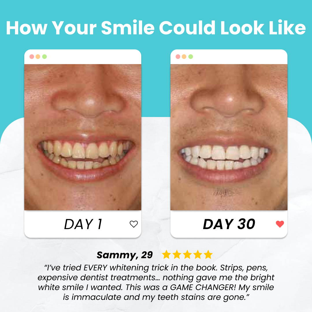 Speedy Smile Toothbrush