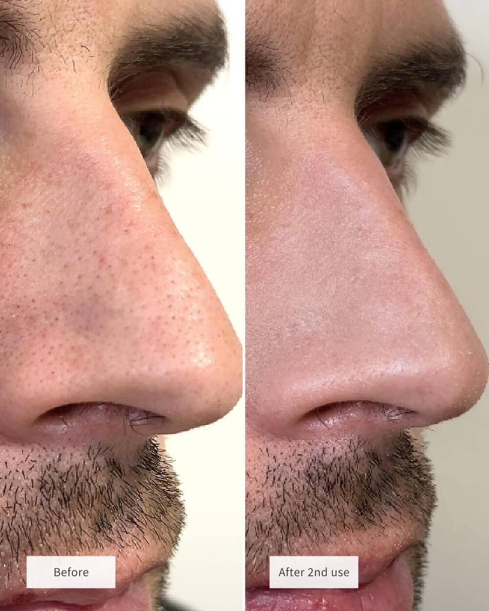 Clear Pores Magic Set