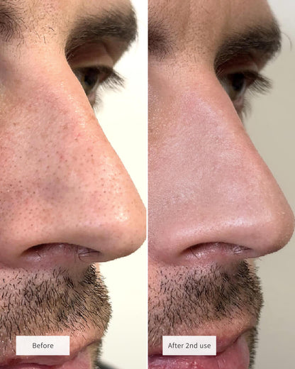 Clear Pores Magic Set