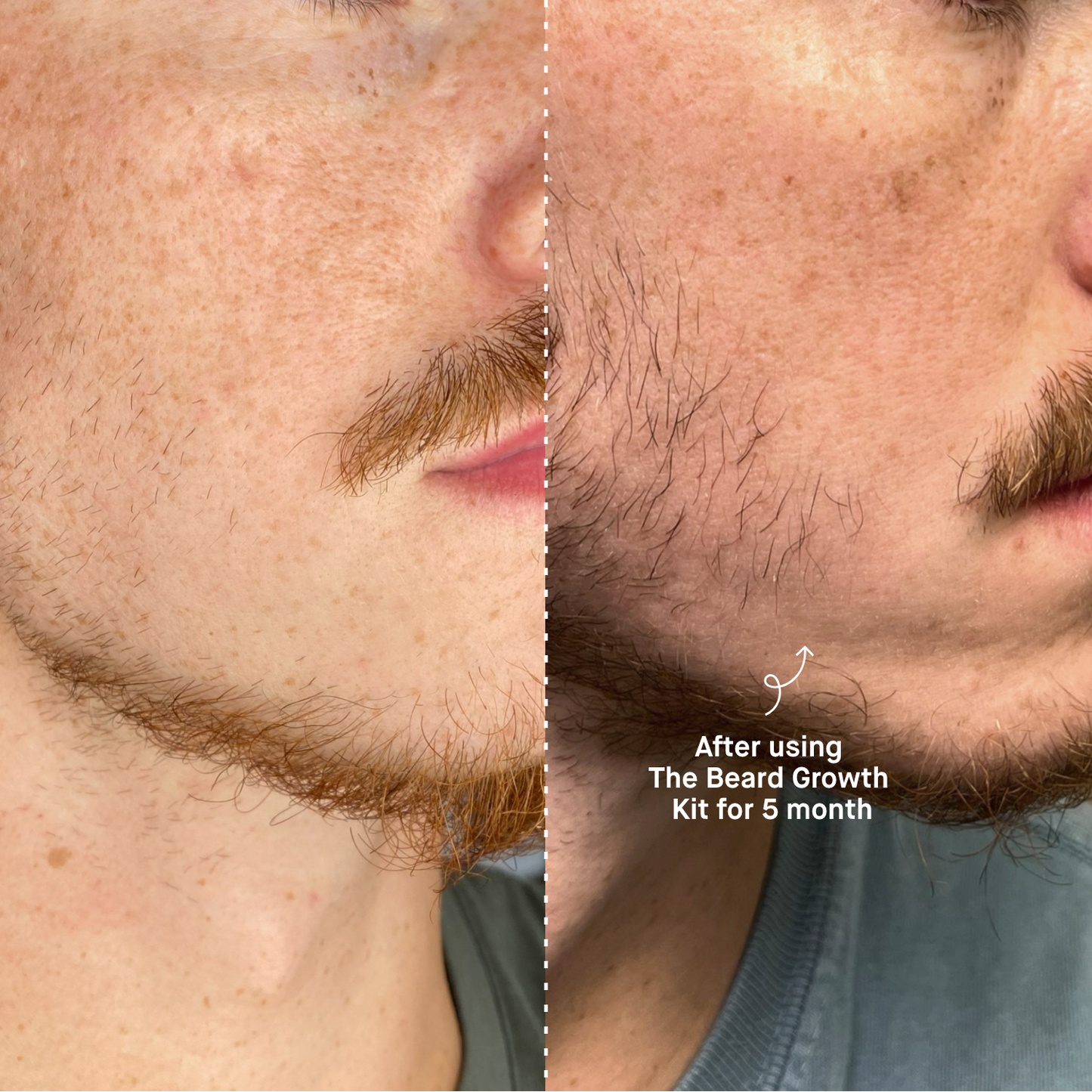 Ultimate Beard Boost Kit