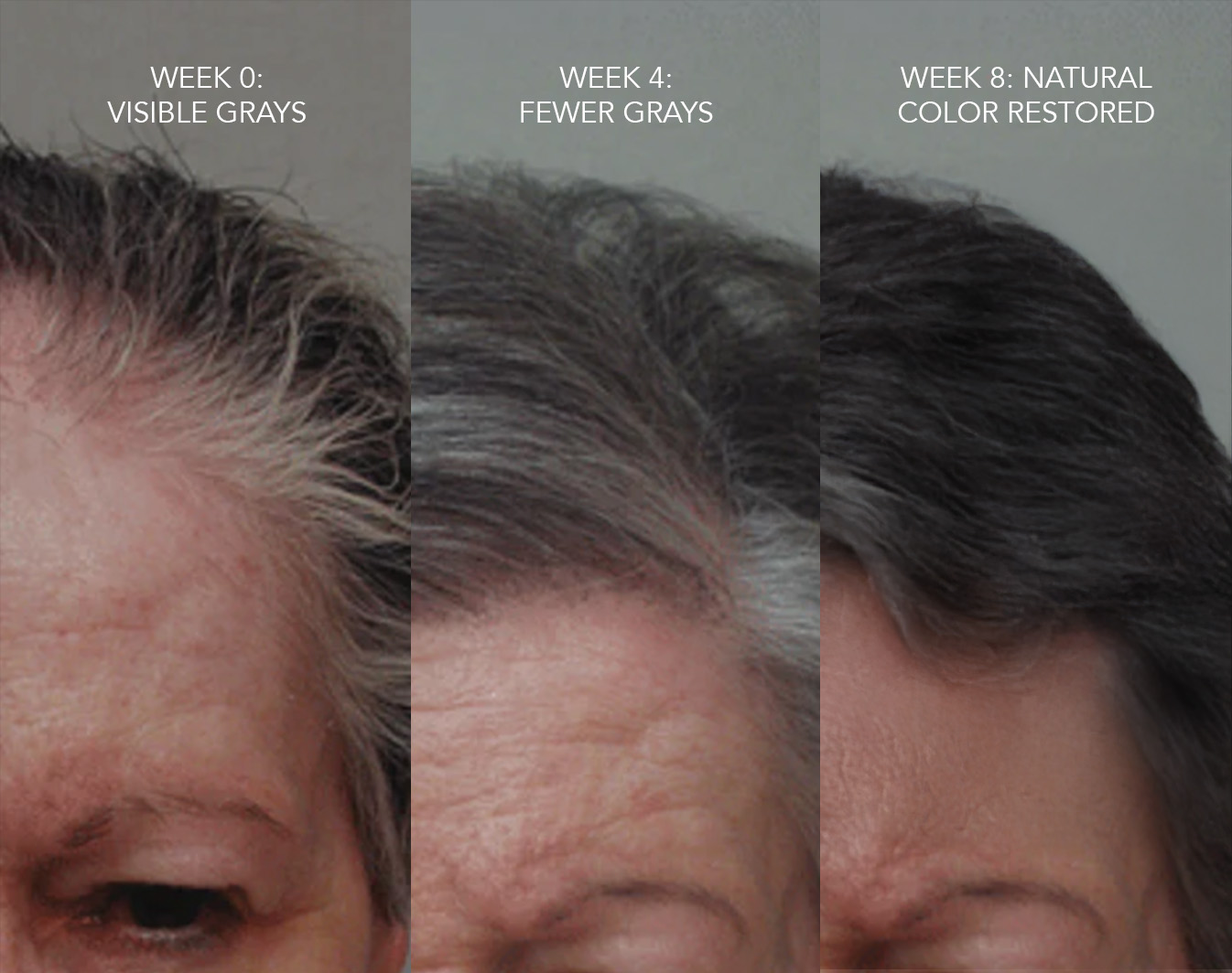 Gray Hair Rescue Serum