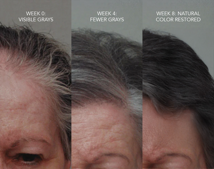 Gray Hair Rescue Serum