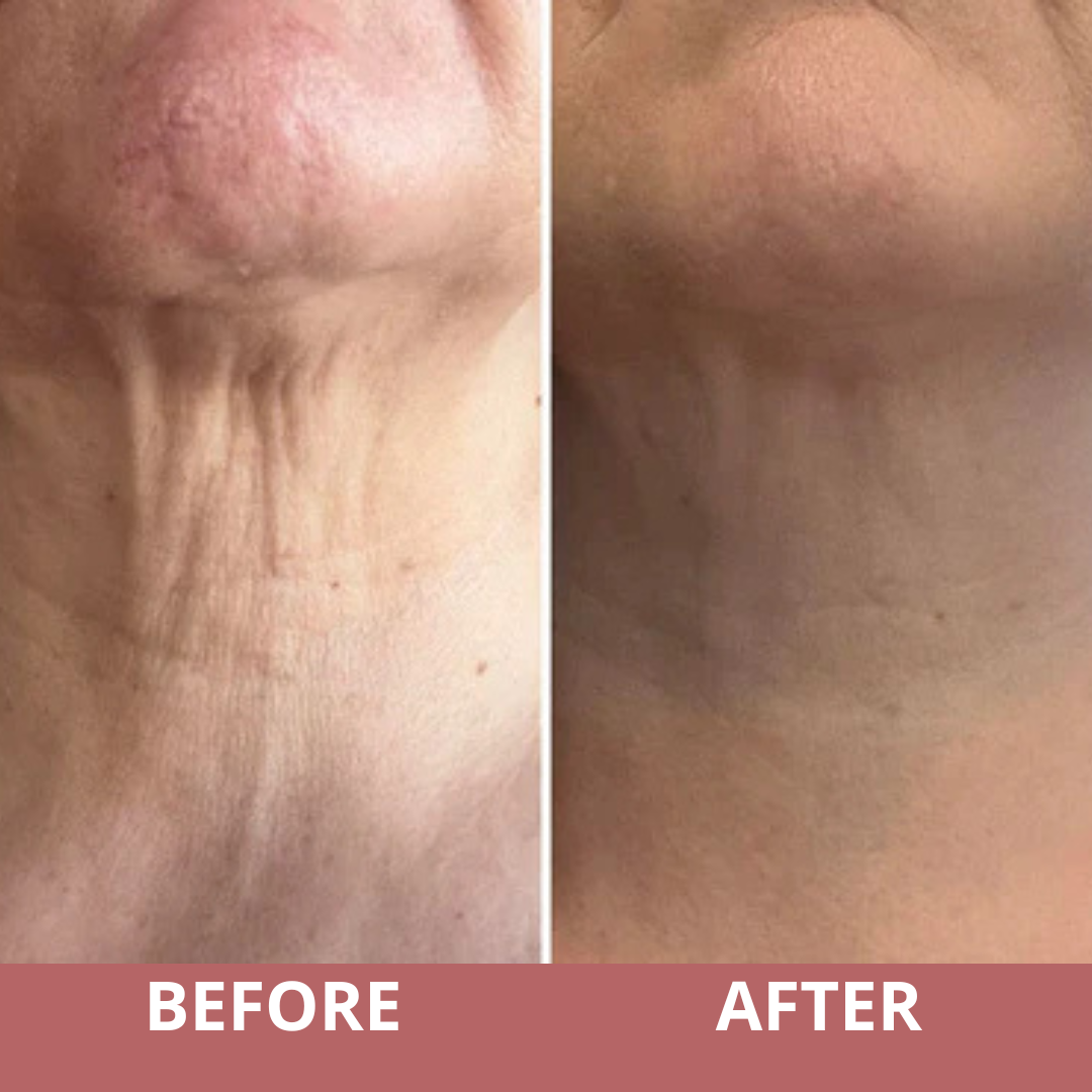 Youthful Neck Revitalizing Cream