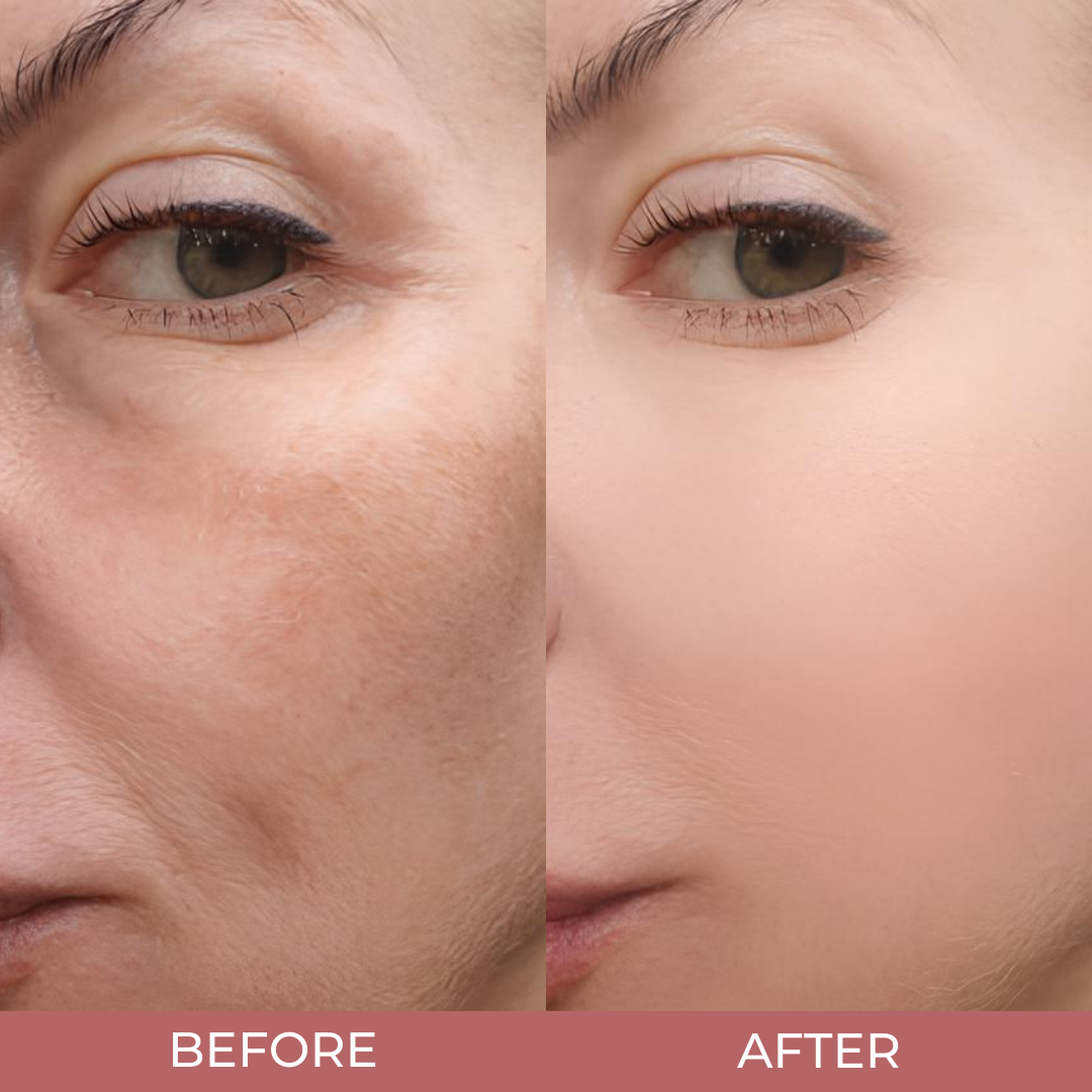 Radiant Glow Rice Ampoule Duo