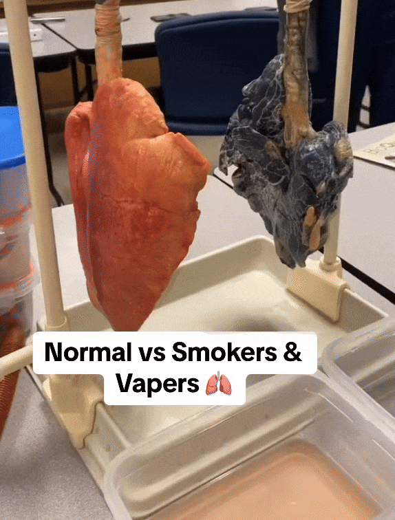 Breathlace Quit Smoking Aid
