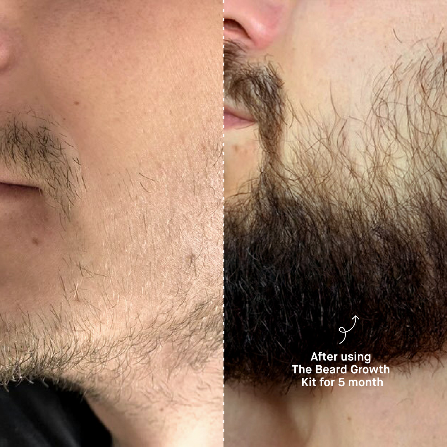 Ultimate Beard Boost Kit