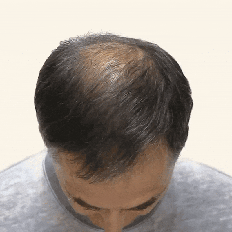 Instant Hair Magic Powder