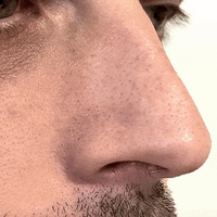ClearSkin Nose Patches