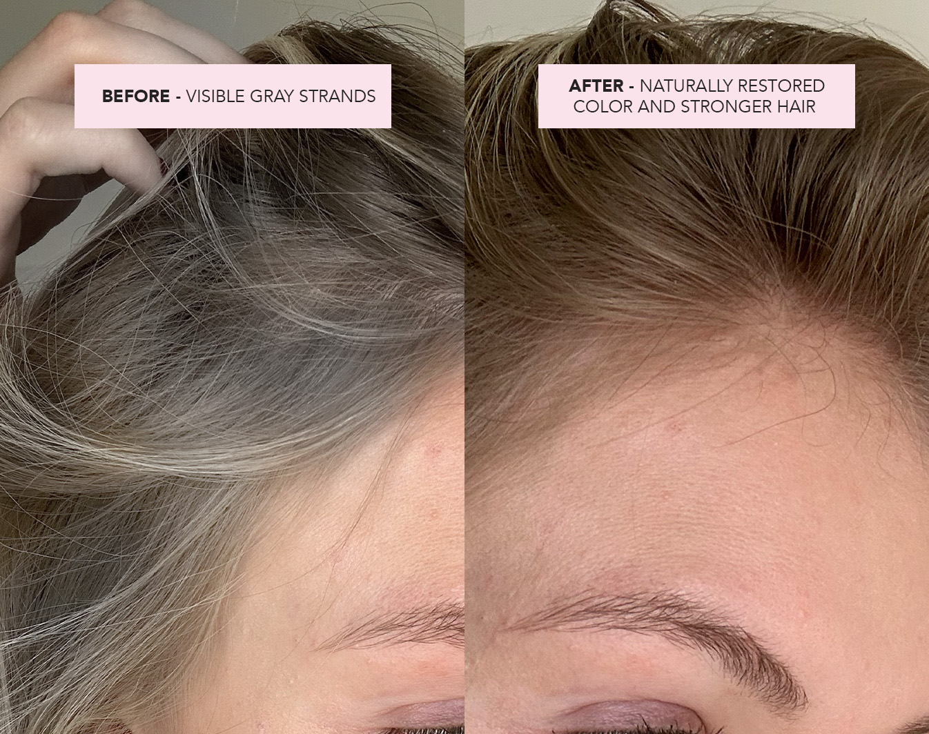 Gray Hair Rescue Serum
